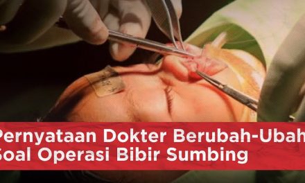 Operasi Rekonstruksi Sumbing Langkah Jadi Menuju Percaya Diri