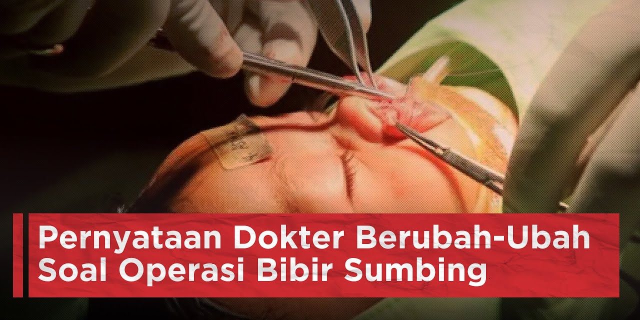 Operasi Rekonstruksi Sumbing Langkah Jadi Menuju Percaya Diri